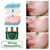 BREYLEE Acne Treatment Cream, 2 image